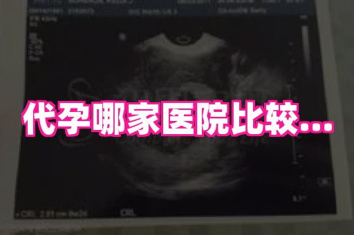 长春助孕网 4